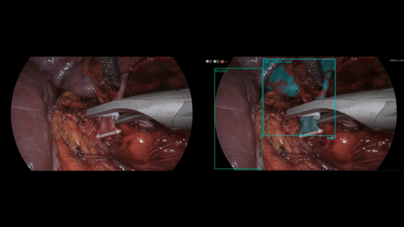 Smart Surgery